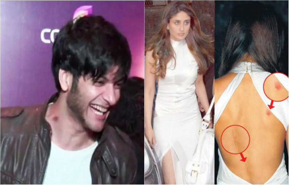 Bollywood stars and their love bites