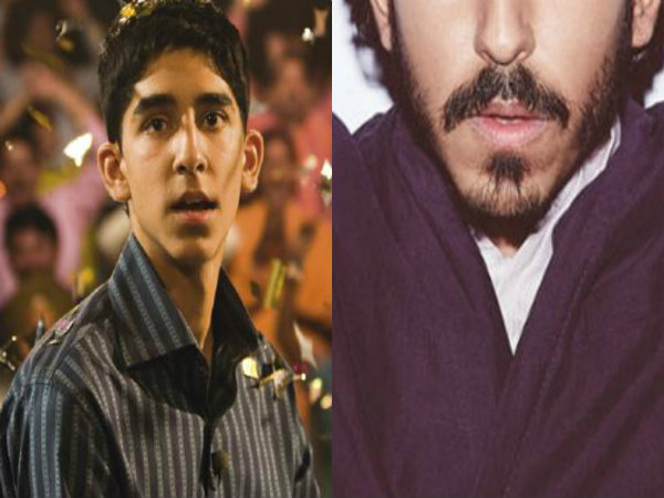 Dev Patel's Transformation - Then and Now