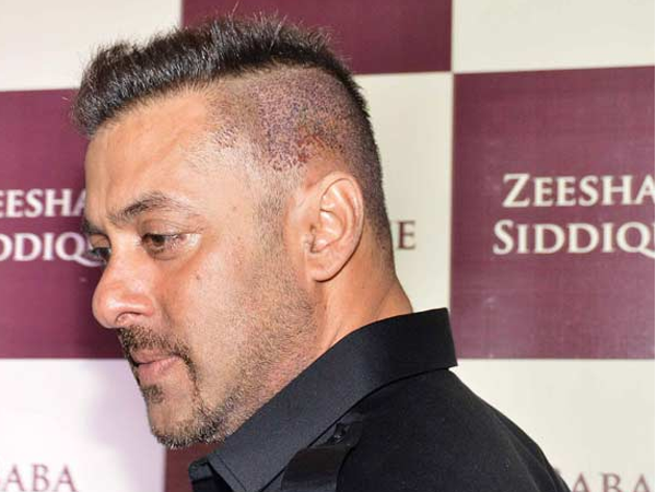 Salman Khan’s bleeding head at Baba Siddique’s Iftaar party was shocking