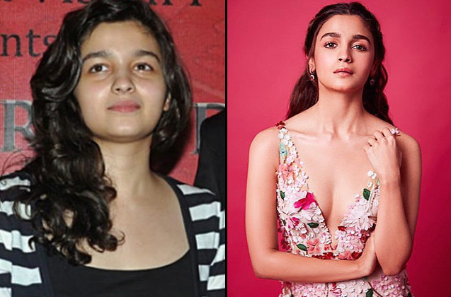 Alia Bhatt, transformation of bollywood star kids, weight loss transformation,